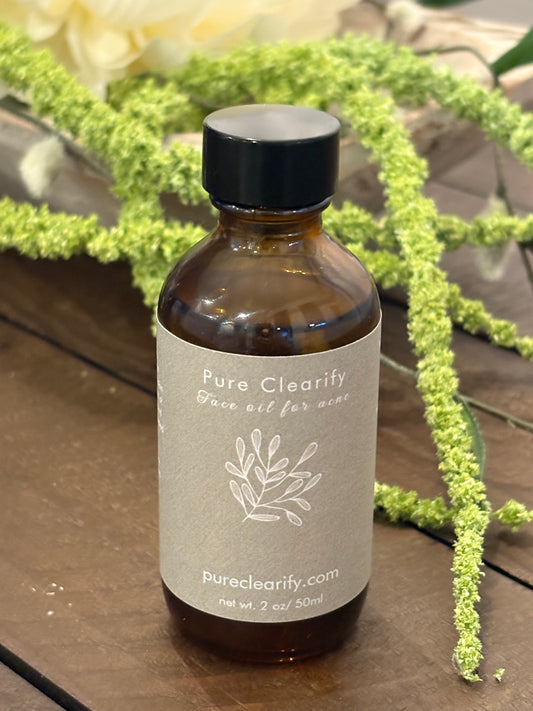 All Natural Essential Oils Acne Treatment 2oz bottle